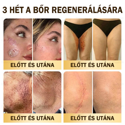 𝓓𝓪𝓪𝓼𝓻𝔂® Méhméreg Bőrjavító Krémkisimítja a ráncokat, hidratál, ragyogóvá teszi a bőrt, hegeket gyógyít, nyugtatja az érzékeny bőrt, és egyenletes tónust ad