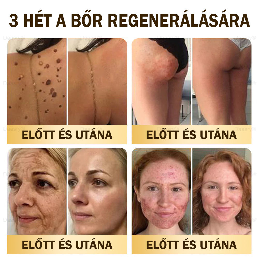 𝓓𝓪𝓪𝓼𝓻𝔂® Méhméreg Bőrjavító Krémkisimítja a ráncokat, hidratál, ragyogóvá teszi a bőrt, hegeket gyógyít, nyugtatja az érzékeny bőrt, és egyenletes tónust ad