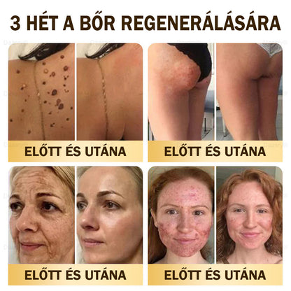 𝓓𝓪𝓪𝓼𝓻𝔂® Méhméreg Bőrjavító Krémkisimítja a ráncokat, hidratál, ragyogóvá teszi a bőrt, hegeket gyógyít, nyugtatja az érzékeny bőrt, és egyenletes tónust ad