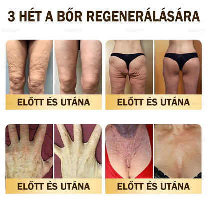 𝓓𝓪𝓪𝓼𝓻𝔂® Méhméreg Bőrjavító Krémkisimítja a ráncokat, hidratál, ragyogóvá teszi a bőrt, hegeket gyógyít, nyugtatja az érzékeny bőrt, és egyenletes tónust ad