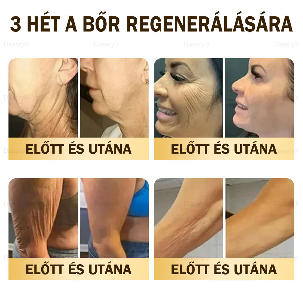 𝓓𝓪𝓪𝓼𝓻𝔂® Méhméreg Bőrjavító Krémkisimítja a ráncokat, hidratál, ragyogóvá teszi a bőrt, hegeket gyógyít, nyugtatja az érzékeny bőrt, és egyenletes tónust ad