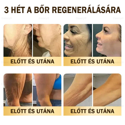 𝓓𝓪𝓪𝓼𝓻𝔂® Méhméreg Bőrjavító Krémkisimítja a ráncokat, hidratál, ragyogóvá teszi a bőrt, hegeket gyógyít, nyugtatja az érzékeny bőrt, és egyenletes tónust ad