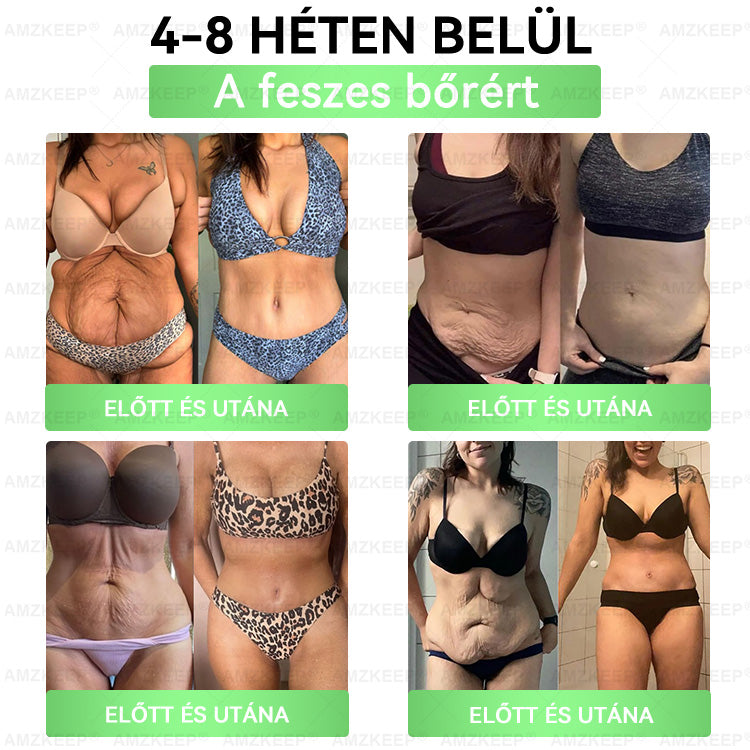🇭🇺 𝐎𝐫𝐯𝐨𝐬𝐨𝐤 á𝐥𝐭𝐚𝐥 𝐟𝐞𝐣𝐥𝐞𝐬𝐳𝐭𝐞𝐭𝐭 𝐀𝐌𝐙𝐊𝐄𝐄𝐏® 𝐌𝐨𝐫𝐢𝐧𝐠𝐚 + 𝐁𝐞𝐫𝐛𝐞𝐫𝐢𝐧 × 𝐍𝐀𝐃+ 𝟏𝟎-𝐚𝐳-𝟏-𝐛𝐞𝐧 𝐟𝐞𝐣𝐥𝐞𝐭𝐭 𝐧𝐚𝐧𝐨 𝐦𝐢𝐤𝐫𝐨𝐭ű𝐬 𝐭𝐚𝐩𝐚𝐬𝐳 – 𝐥á𝐭𝐡𝐚𝐭ó 𝐞𝐫𝐞𝐝𝐦é𝐧𝐲𝐞𝐤 𝐚𝐤á𝐫 𝟕 𝐧𝐚𝐩 𝐚𝐥𝐚𝐭𝐭! nap alatt!