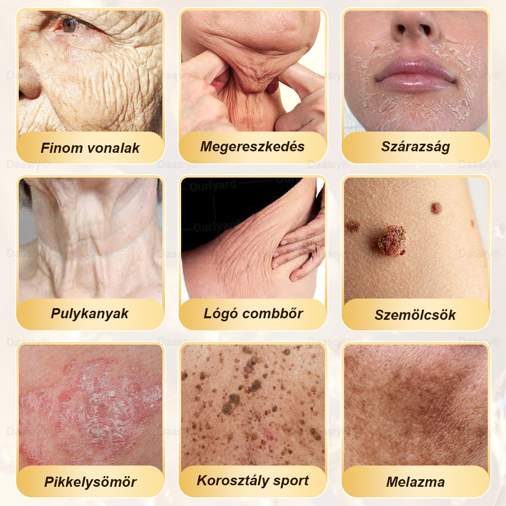 𝓓𝓪𝓪𝓼𝓻𝔂® Méhméreg Bőrjavító Krémkisimítja a ráncokat, hidratál, ragyogóvá teszi a bőrt, hegeket gyógyít, nyugtatja az érzékeny bőrt, és egyenletes tónust ad