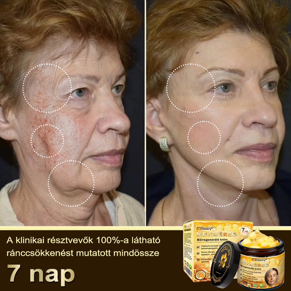 𝓓𝓪𝓪𝓼𝓻𝔂® Méhméreg Bőrjavító Krémkisimítja a ráncokat, hidratál, ragyogóvá teszi a bőrt, hegeket gyógyít, nyugtatja az érzékeny bőrt, és egyenletes tónust ad