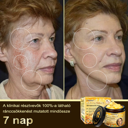 𝓓𝓪𝓪𝓼𝓻𝔂® Méhméreg Bőrjavító Krémkisimítja a ráncokat, hidratál, ragyogóvá teszi a bőrt, hegeket gyógyít, nyugtatja az érzékeny bőrt, és egyenletes tónust ad