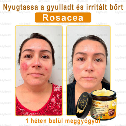 🎉 Ne hagyd ki! Csak 5 doboz van hátra! 🕔 Most extra 50% kedvezményt kínálunk! 💥 Tedd meg az első lépést az egészséges életmód felé. Ha most nem döntesz, csak jövőre kapod meg a következő esélyt!