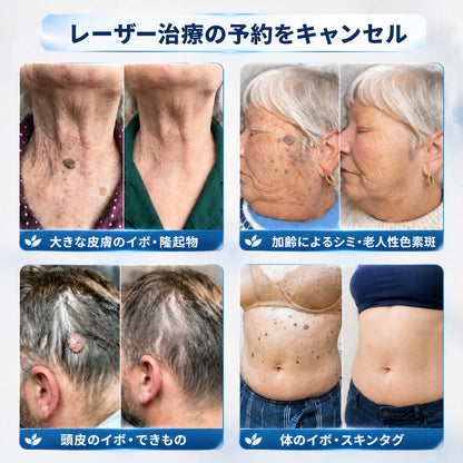 👑薬剤師もおすすめ💕 Hiskin® 7日間 タグ＆スポットイレーサー🪄 （痛みゼロ・傷あとゼロを目指すローラーボールタイプ）👩‍⚕️