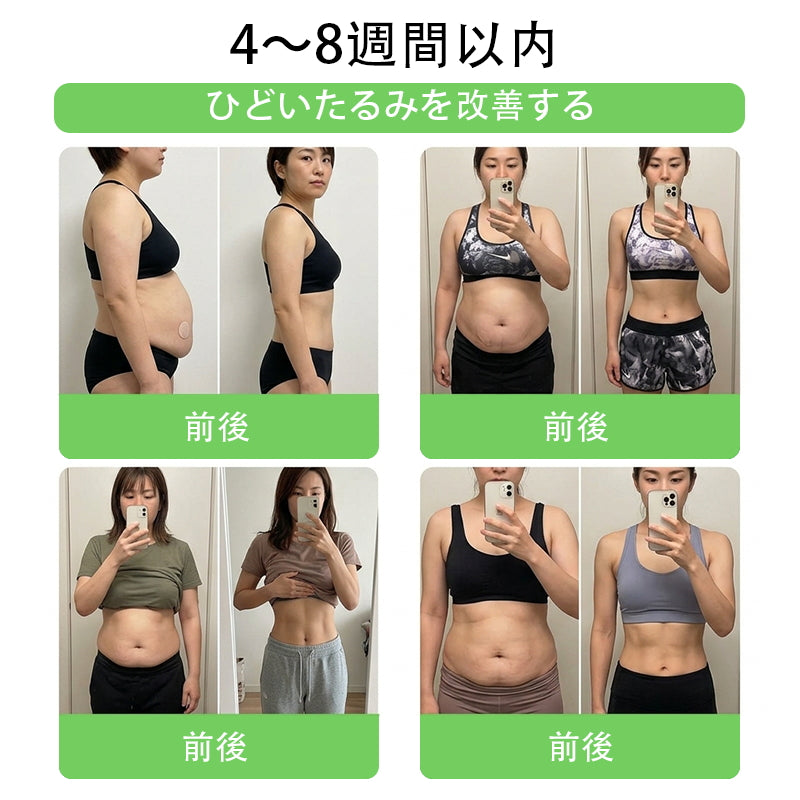 🏥 𝑨𝑴𝒁𝑲𝑬𝑬𝑷® NAD+ モリンガ・ベルベリン AMPKサポート ナノマイクロニードルパッチ ✅（1日たった1回、7日間で目に見える変化）｜ベルベリン＋モリンガ配合｜肥満、たるんだ皮膚、糖尿病、睡眠時無呼吸症候群、関節の問題などに対応 💯🚀