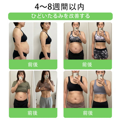 🏥 𝑨𝑴𝒁𝑲𝑬𝑬𝑷® NAD+ モリンガ・ベルベリン AMPKサポート ナノマイクロニードルパッチ ✅（1日たった1回、7日間で目に見える変化）｜ベルベリン＋モリンガ配合｜肥満、たるんだ皮膚、糖尿病、睡眠時無呼吸症候群、関節の問題などに対応 💯🚀