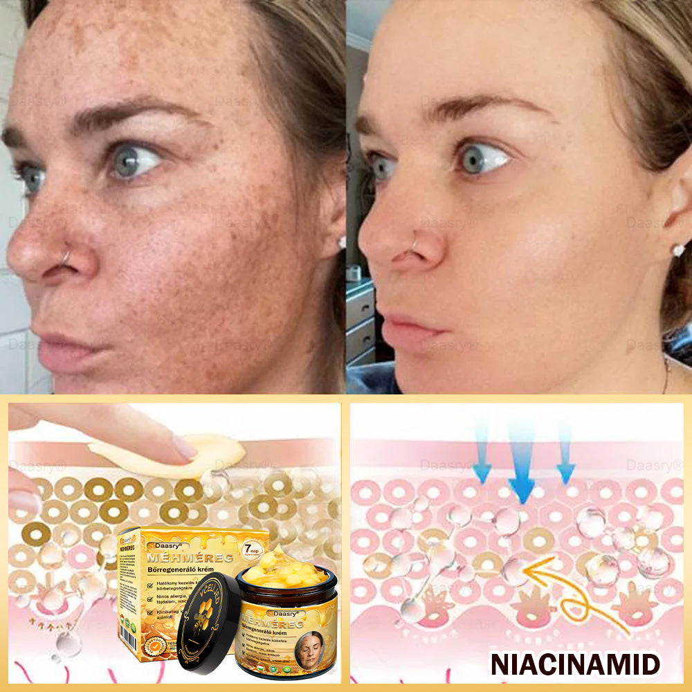 𝓓𝓪𝓪𝓼𝓻𝔂® Méhméreg Bőrjavító Krémkisimítja a ráncokat, hidratál, ragyogóvá teszi a bőrt, hegeket gyógyít, nyugtatja az érzékeny bőrt, és egyenletes tónust ad