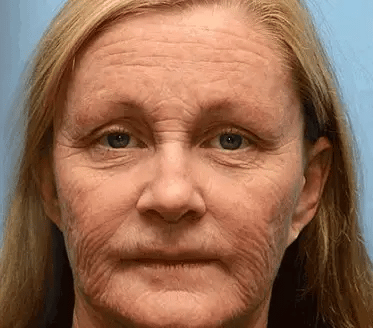 🎉 Ne hagyd ki! Csak 5 doboz van hátra! 🕔 Most extra 50% kedvezményt kínálunk! 💥 Tedd meg az első lépést az egészséges életmód felé. Ha most nem döntesz, csak jövőre kapod meg a következő esélyt!